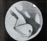 m087 (Untitled)